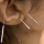 Manfaat Aurikuloterapi/ Terapi Akupuktur Telinga
